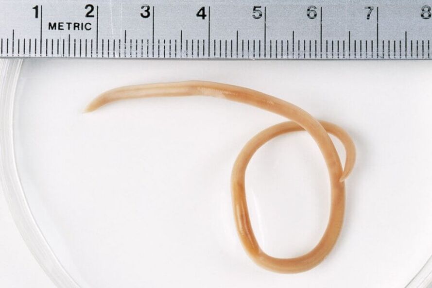 pinworm iz ljudskog tijela