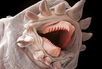 što crvi mogu živjeti u ljudskom tijelu