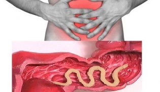 simptomi prisutnosti parazita u ljudskom crijevu
